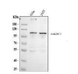 Anti-HKDC1 Antibody Picoband® Boster Bio
