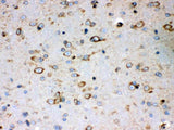 Anti-Peroxiredoxin 4/PRDX4 Antibody Picoband® Boster Bio