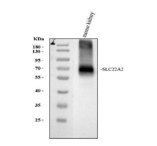 Anti-SLC22A2 Antibody Picoband® Boster Bio