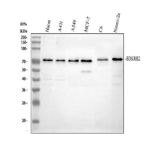 Anti-BDKRB2 Antibody Picoband® Boster Bio