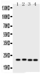 Anti-SOCS2 Antibody Picoband® Boster Bio