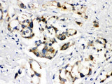 Anti-ABCB11 Antibody Picoband® Boster Bio
