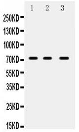 Anti-ABCG5 Antibody Picoband® Boster Bio