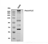 Anti-Plectin Antibody Picoband® Boster Bio