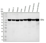Anti-SDHA Antibody Picoband® Boster Bio