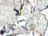 Anti-WASP Antibody Picoband® Boster Bio