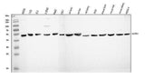 Anti-Angiotensin II Type 1 Receptor/AGTR1 Antibody Picoband® Boster Bio