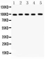 Anti-Aspartate beta hydroxylase/ASPH Antibody Picoband® Boster Bio