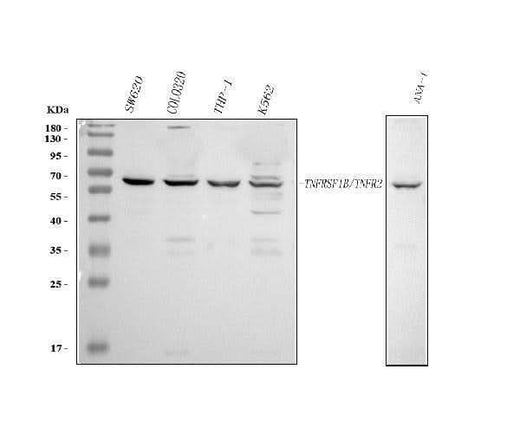 Anti-TNF Receptor II/TNFRSF1B Antibody Picoband® Boster Bio