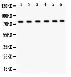Anti-TRPV5 Antibody Picoband® Boster Bio