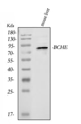 Anti-Butyrylcholinesterase/BCHE Antibody Picoband® Boster Bio