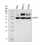 Anti-HRPT2/CDC73 Antibody Picoband® Boster Bio