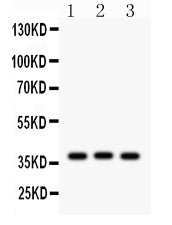 Anti-CTGF Antibody Picoband® Boster Bio