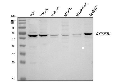 Anti-CYP27B1 Antibody Picoband® Boster Bio