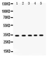 Anti-EBAG9 Antibody Picoband® Boster Bio