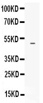 Anti-Endothelin B Receptor/EDNRB Antibody Picoband® Boster Bio