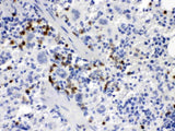 Anti-MCSF/CSF1 Antibody Boster Bio