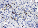 Anti-MCSF/CSF1 Antibody Boster Bio