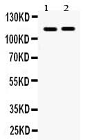Anti-Eph receptor A5/EPHA5 Antibody Picoband® Boster Bio