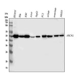 Anti-Fascin/FSCN1 Antibody Picoband® Boster Bio