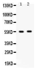 Anti-GABA A Receptor beta 3/GABRB3 Antibody Picoband® Boster Bio