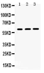Anti-HNF1 beta/HNF1B Antibody Picoband® Boster Bio