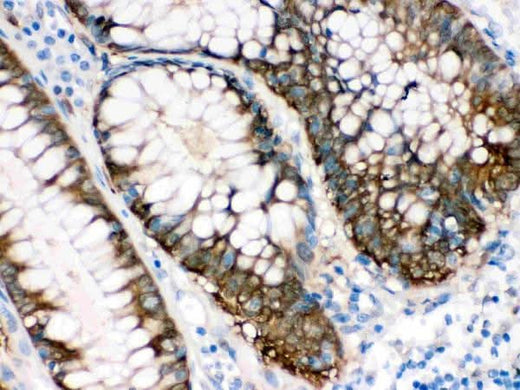 Anti-Isocitrate dehydrogenase/IDH1 Antibody Picoband® Boster Bio
