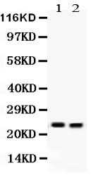 Anti-Lipocalin 2/LCN2 Antibody Picoband® Boster Bio
