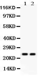 Anti-Lipocalin 2/LCN2 Antibody Picoband® Boster Bio