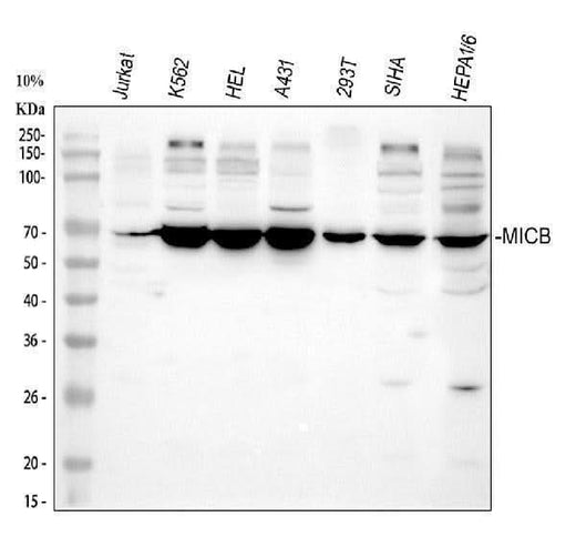 Anti-MICB Antibody Picoband® Boster Bio