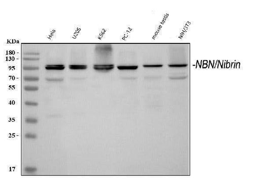 Anti-p95 NBS1/NBN Antibody Picoband® Boster Bio