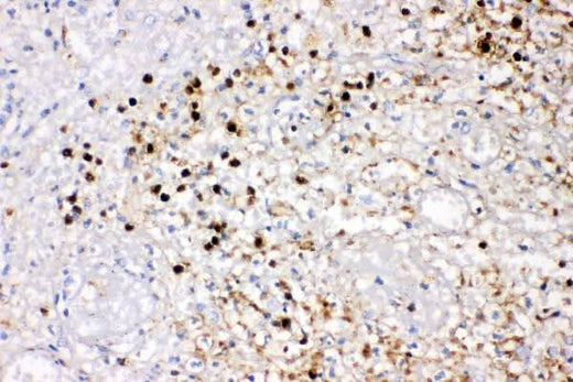 Anti-IL8/CXCL8 Antibody Picoband® Boster Bio