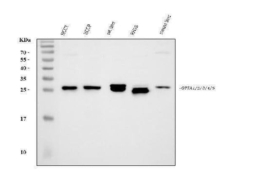 Anti-GSTA1/GSTA2/GSTA3/GSTA4/GSTA5 Antibody Picoband® Boster Bio