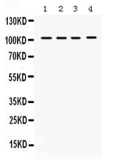Anti-HDAC7 Antibody Picoband® Boster Bio