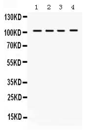 Anti-HDAC7 Antibody Picoband® Boster Bio