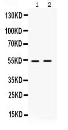 Anti-HSF4 Antibody Picoband® Boster Bio
