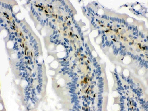 Anti-Hsp70/HSPA1A/HSPA1B Antibody Picoband® Boster Bio