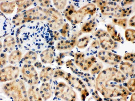 Anti-Hsc70/HSPA8 Antibody Picoband® Boster Bio