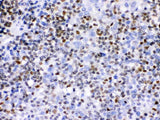Anti-Ikaros/IKZF1 Antibody Picoband® Boster Bio