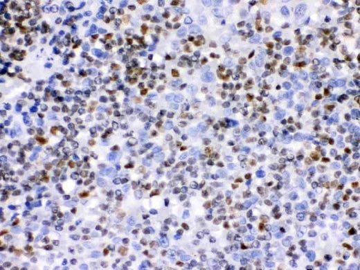 Anti-Ikaros/IKZF1 Antibody Picoband® Boster Bio