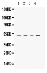 Anti-Keratocan Antibody Picoband® Boster Bio