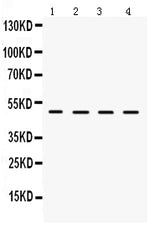 Anti-LCAT Antibody Picoband® Boster Bio