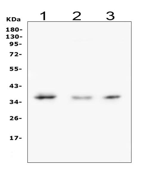 Anti-Galectin 8/LGALS8 Antibody Picoband® Boster Bio
