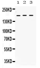 Anti-LIFR Antibody Picoband® Boster Bio