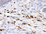 Anti-Lysozyme/LYZ Antibody Picoband® Boster Bio