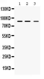 Anti-MEFV Antibody Picoband® Boster Bio
