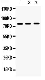 Anti-MMP9 Antibody Picoband® Boster Bio