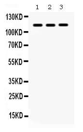 Anti-CARD12/NLRC4 Antibody Picoband® Boster Bio