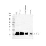 Anti-S100 alpha 6/S100A6 Antibody Picoband® Boster Bio