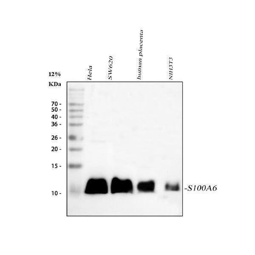 Anti-S100 alpha 6/S100A6 Antibody Picoband® Boster Bio